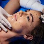 What You Can Expect From Cosmetic Surgeon